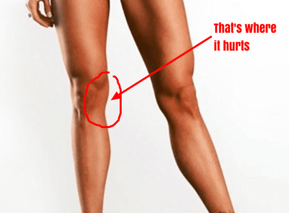 Medial Knee Pain (Inside) - Symptoms, Causes, Treatment & Rehab